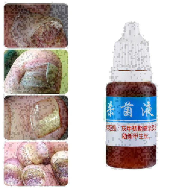 10ml Nail Repair Treatment Liquid Cleanser Onychomycosis Disinfect Water ne U6U7