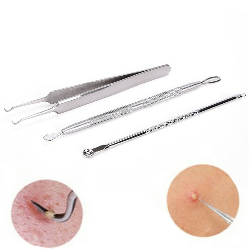 3Pcs Stainless Steel Facial Acne Spot Pimple Remover Extractor Tool CleanserS Gw