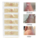 42Pcs Medical Plasters Foot Corn Removal Warts Thorn Patch Curative Patches T6J8