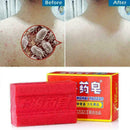 Medicated soap Oil-control Blackhead Remover Acne Treatment Cleanse Whiteni G0H1