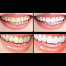 Fluoride Free Activated Charcoal Teeth Whitening Toothpaste Freshens Breath