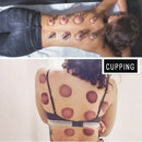 24 Cups / Set Chinese Air Suction Cupping Massage  Cup