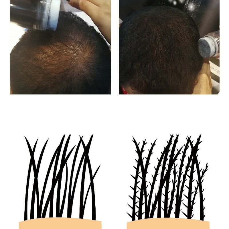 Sevich 12G Keratin Hair Building Fiber Thickening Hair Spray Powder For Hai Q9I4