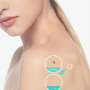 36PCS Fast Remover Pimple Patch Treatment Acne Patch Skin Tag Beauty Makeup  Nw