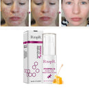 RtopR Propolis Repair Acne Brightening Serum Acne Scar Spots Cleaning Serum