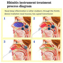 Nose Rhinitis Sinusitis Cure Therapy Massage Hay Fever Pulse Frequency Low Z2D4