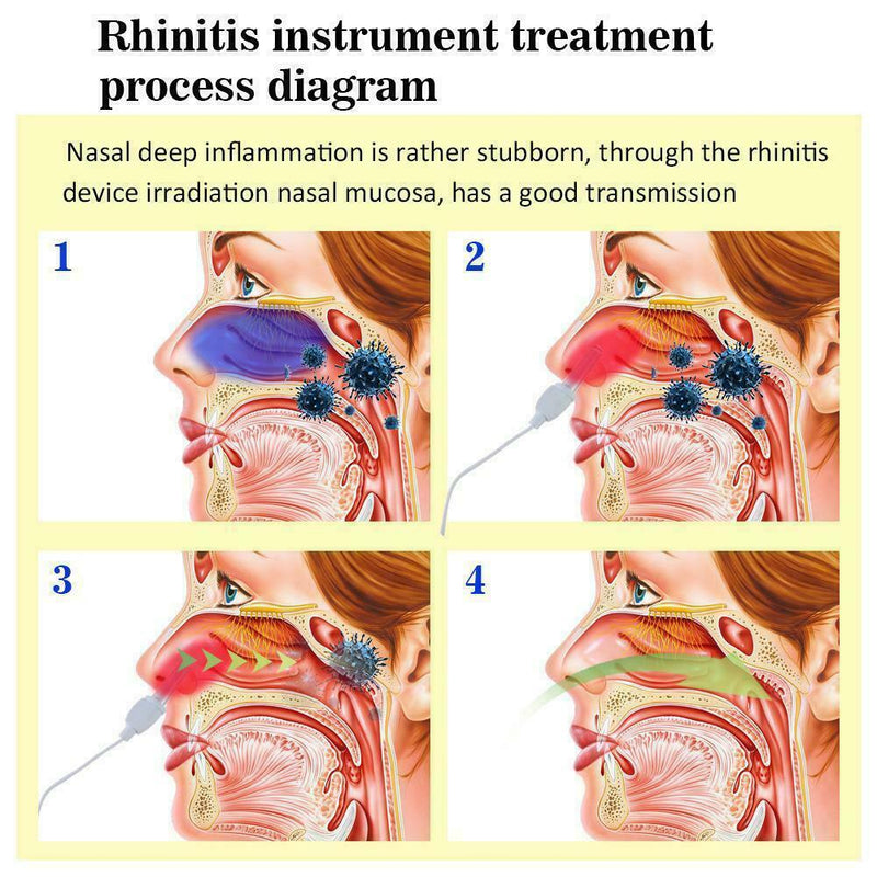 Nose Rhinitis Sinusitis Cure Therapy Massage Hay Fever Pulse Frequency Low Z2D4