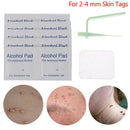 Skin Tag Remover Kit For Fast & Effective Small To Medium Skin Tag Removal S Bj
