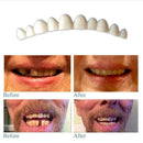 Tooth Kit DELUXE 3 SHADES of Temporary Teeth Included Super C3O5 K0R8 S8J7