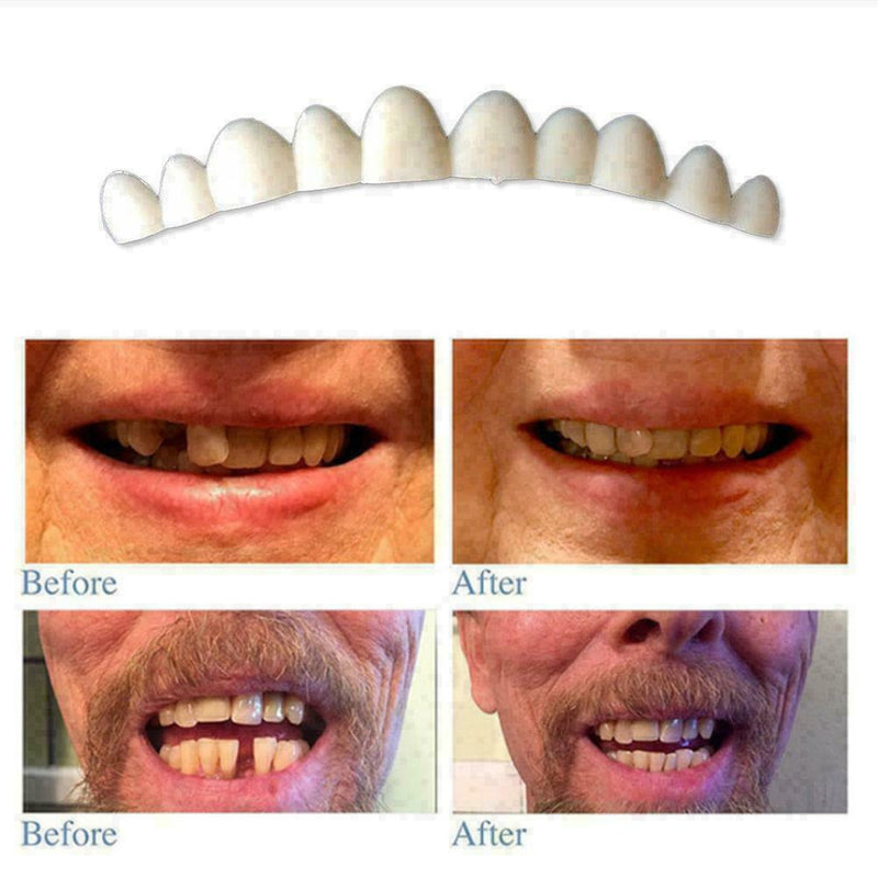 Tooth Kit DELUXE 3 SHADES of Temporary Teeth Included Super C3O5 K0R8 S8J7