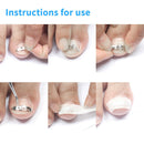 Ingrown Toe Nail Recover Correction Patch Pedicure Toenail Fixer Foot Care T Pg