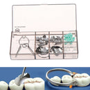 60Pcs Dental Matrix Sectional Contoured Metal Matrices Elastic Wedges SpringSEAU