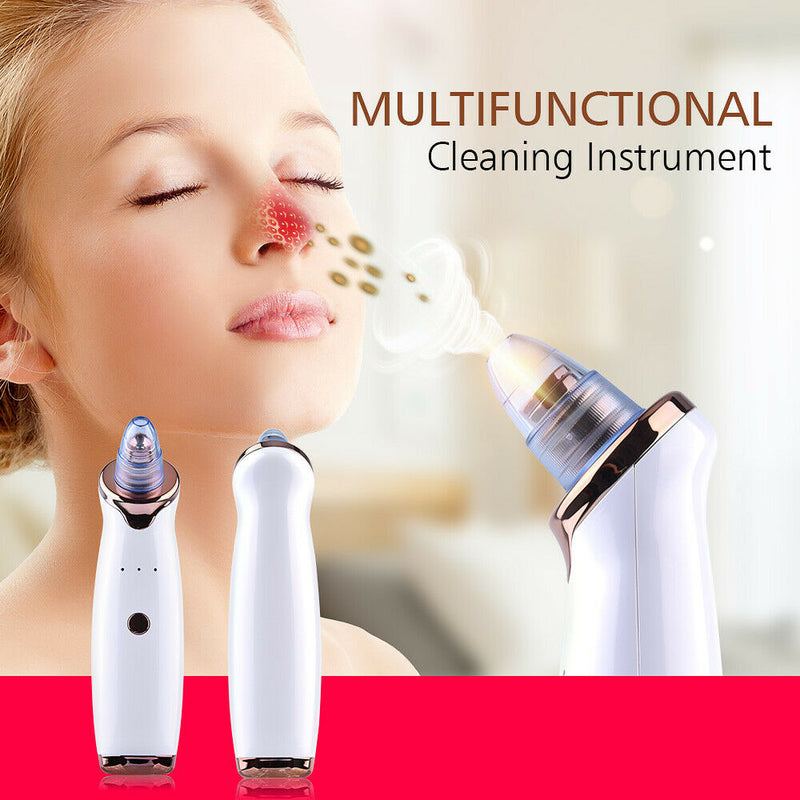 Rechargeable Electric Blackhead Remover Face Pore Acne Vacuum Suction Cleaner ST