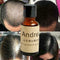 Hair Growth EssenceAndrea Liquid Oil Natural Organic Regrowth Treatment Sup T8Z6