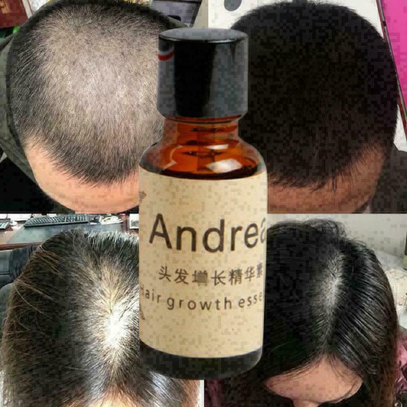 Hair Growth EssenceAndrea Liquid Oil Natural Organic Regrowth Treatment Sup T8Z6