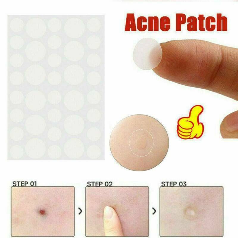 72PCS Skin Tag & Acne Patch - 2021 NEW Hydrocolloid Acne and Skin Tag Remover