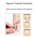 6Pcs Ingrown Toenail Tools Kit, Premium Nail Treatment Foot  Pedicure Tools