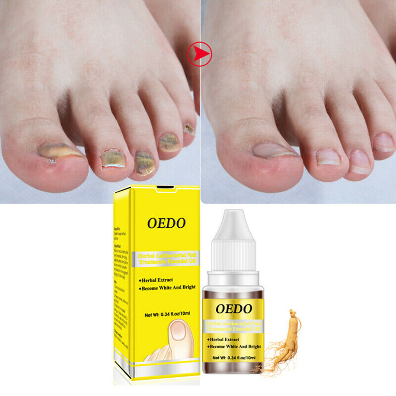 Oedo herbal Antibacterial Nail Treatments Essential Oil Herbal Extract Nail A4R7