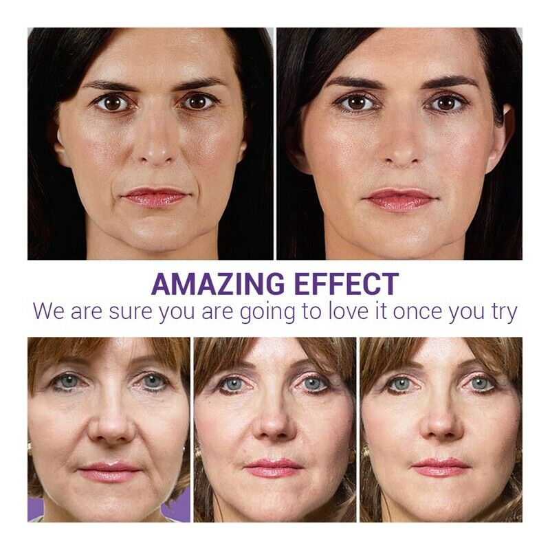 Lanbena Blueberry Hyaluronic Acid Serum Whitening Reduces Fine Lines Anti-A P9L9