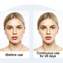 2x V Face Massager Device Facial Lifting  Tightening Skin Care White