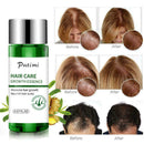 Hair Growth Dense Regrowth Ginger Serum Oil Anti Loss 20ML Treatment Essenc E7M5
