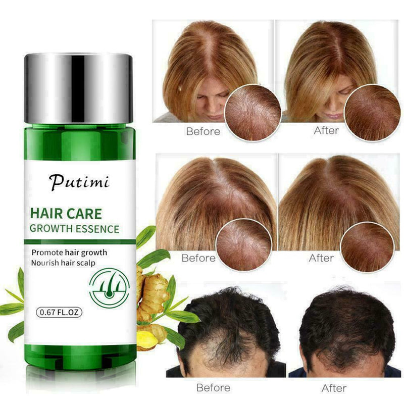 Hair Growth Dense Regrowth Ginger Serum Oil Anti Loss 20ML Treatment Essenc E7M5