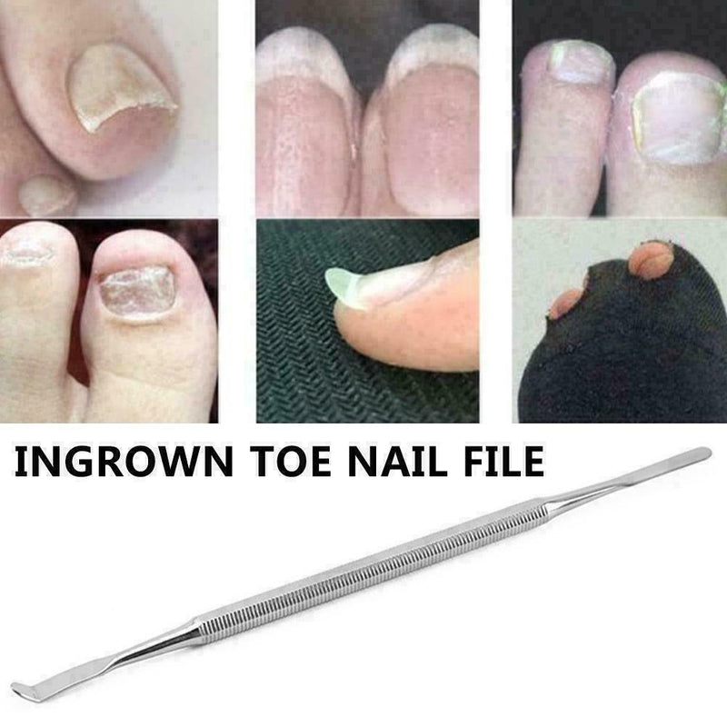 Ingrown Toe Nail Lifter Podiatry Chiropody Instruments Good C8O5 Brand G2B0