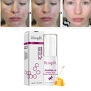 RtopR Propolis Repair Acne Brightening Serum Acne Scar Spots Cleaning Serum K9M4