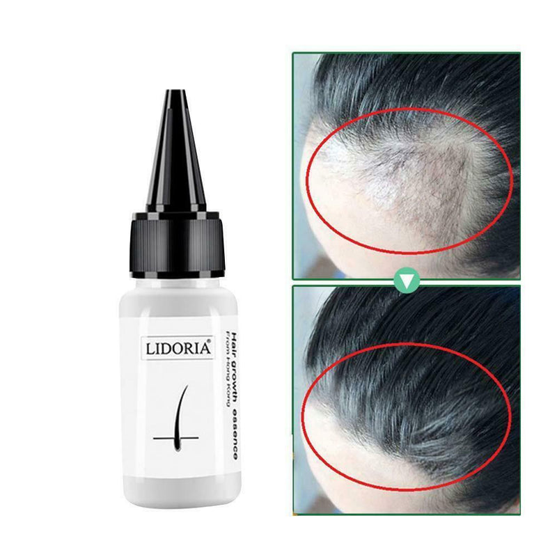 20ml Polygonum Multiflorum Hair Conditioner Fast Hair Growth Essence Oils