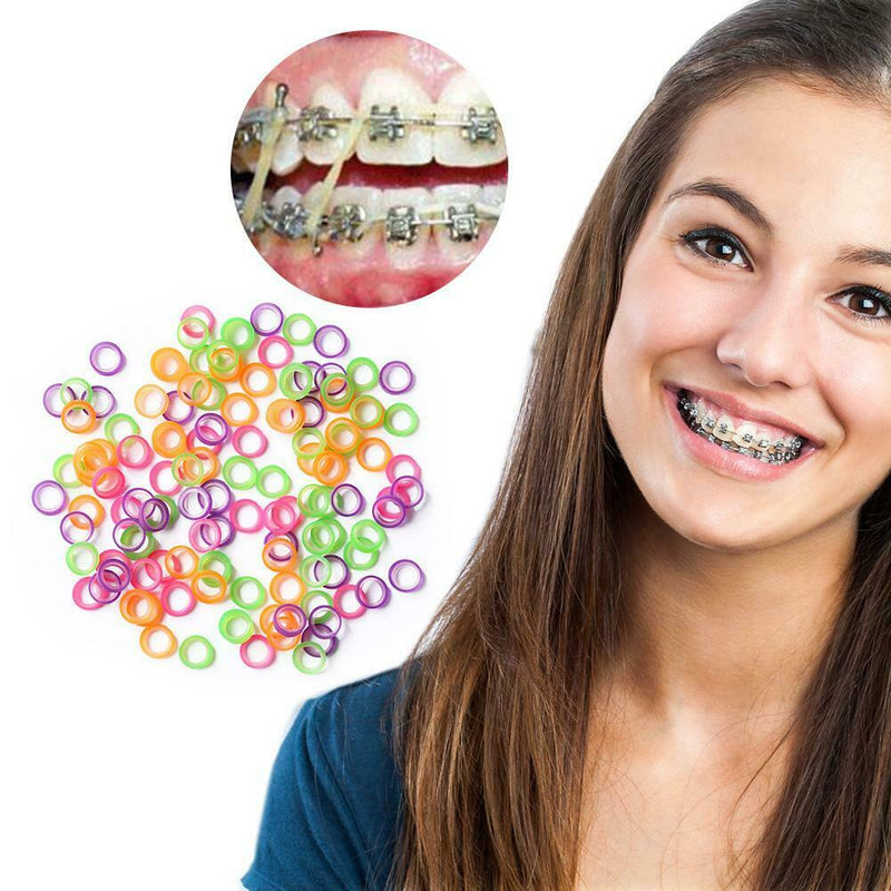 100pcs Orthodontic Rubber Bands Latex Braces Transparent Traction (1/8)
