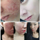 Skin Menu 100G Bamboo Charcoal Sea Salt Acne Treatments Handmade Soap Oil C