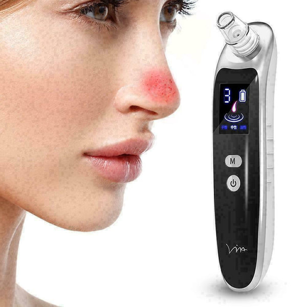 Electric Acne Blackhead Vacuum Cleaner Pore Skin Care W9C8 Deep Cleansing J J2G5