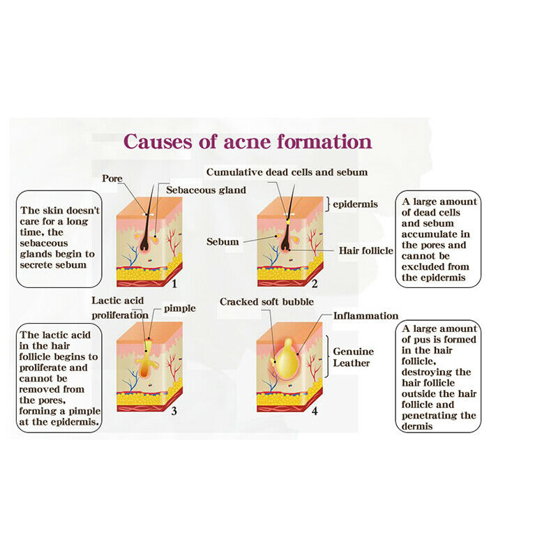 RtopR Propolis Repair Acne Brightening Serum Acne Scar Spots Cleaning Serum K9M4