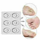 Silicone Gel Toes Instant Corn Pads Plaster Cushion Foot 6pcs Relief set Pa U3H4