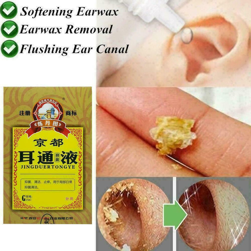 Ear Acute Otitis Drops Chinese Herbal Medicine For Ears Deafness Tinnitus S Z9R5