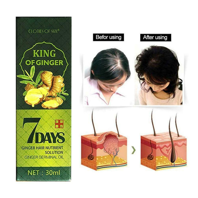 Herbal Ginger Essence for Hair Growth Hair Essential Oil Anti Hair Lose 30ml