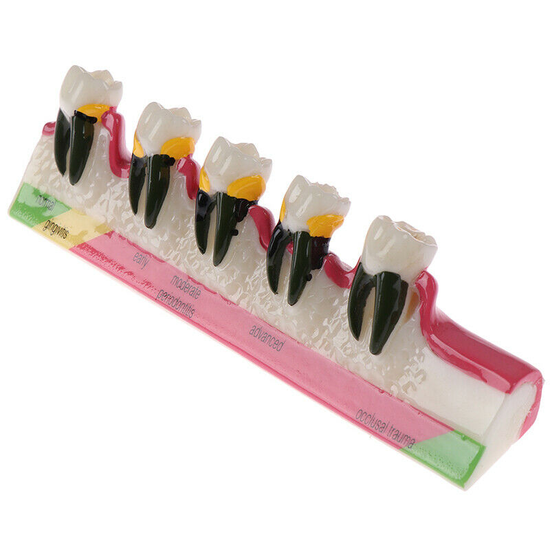 Dental Lab Periodontal Disease Assort Tooth Typodont Study Teaching Teeth Mo BX