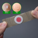 42Pcs Sumifun Foot Corn Removal Plaster Calluses Plantar Treatment PainReliev FT