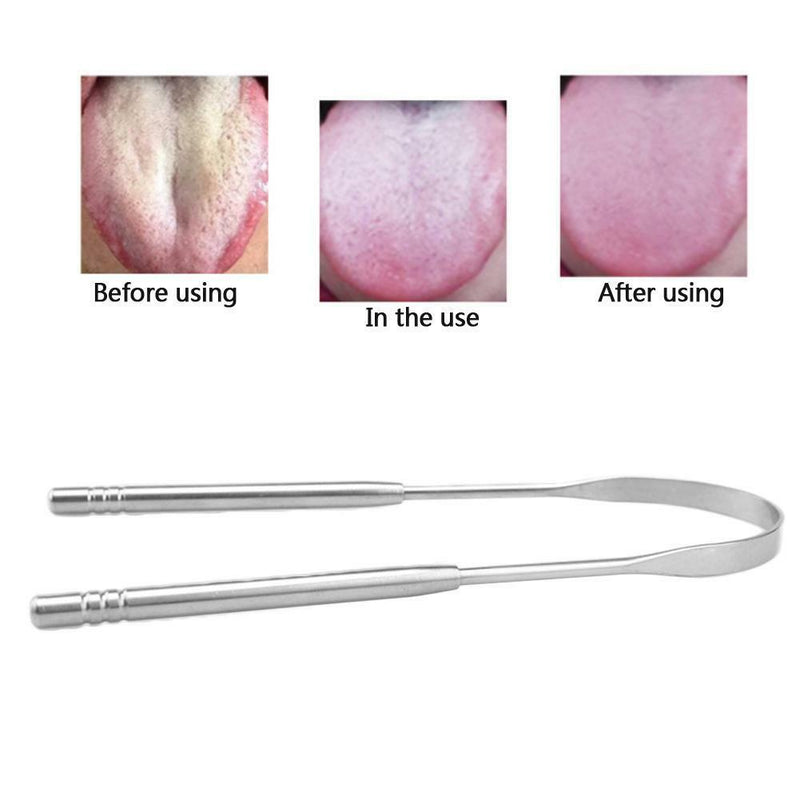 2019 Stainless Steel Tongue Cleaner Scraper Oral Hygiene Bad Breath Care Health
