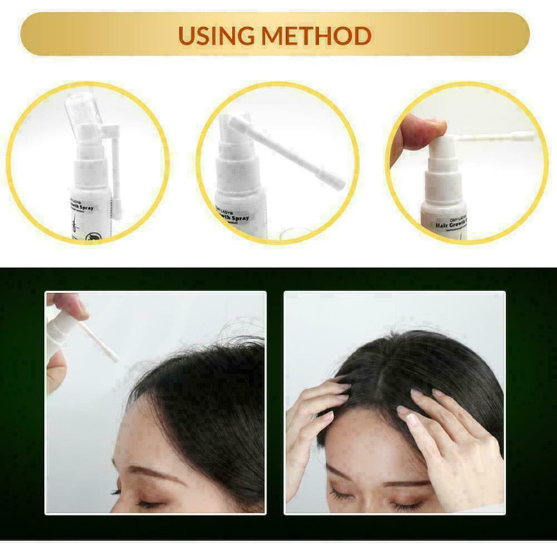 Anti Hair Loss Hair Growth Spray Essential Liquid Dry Repair Regeneration T Z4C9