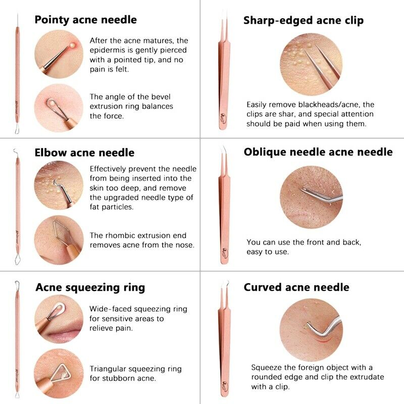 Blackhead Remover Comedone Extractor, 6 PCS Acne Tool Removal Kit Multi-Fun O3C5