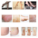 10PCS Foot Portable File Dead Hard Skin Callus Remover Scraper Pedicure -OZ