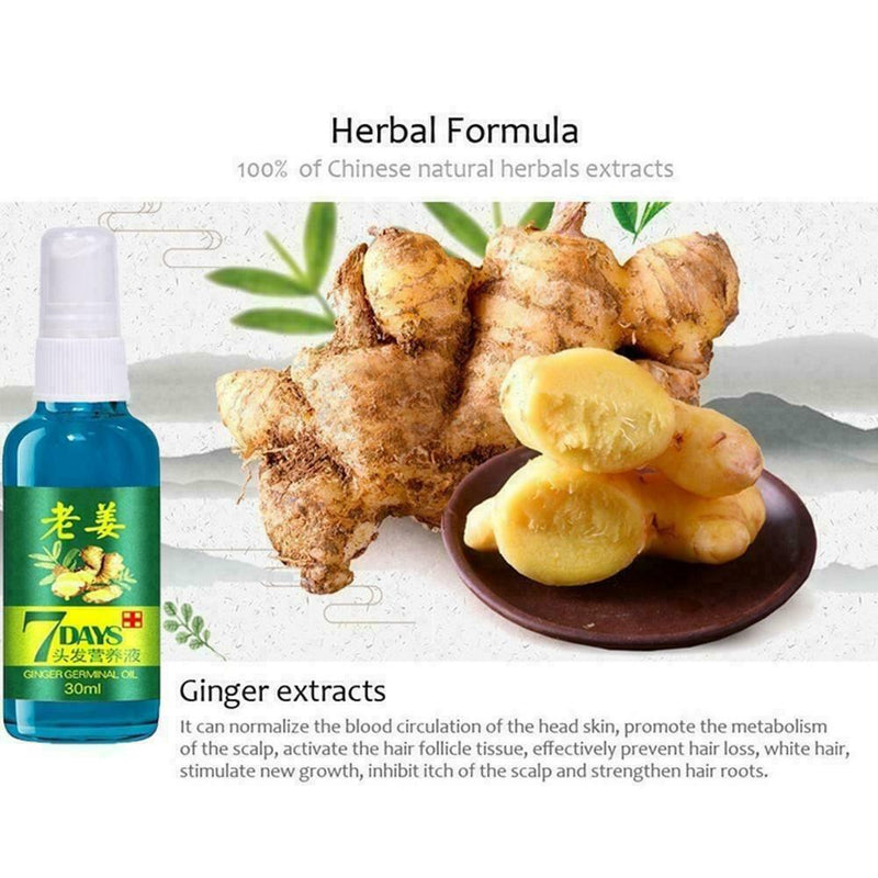 30ML Fast Hair Growth Ginger Liquid Hair Loss Treatment Care Hair E6R2