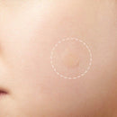 24pcs/set Cosrx Acne Pimple Patches Face Spot Scar Care Treatment Stickers