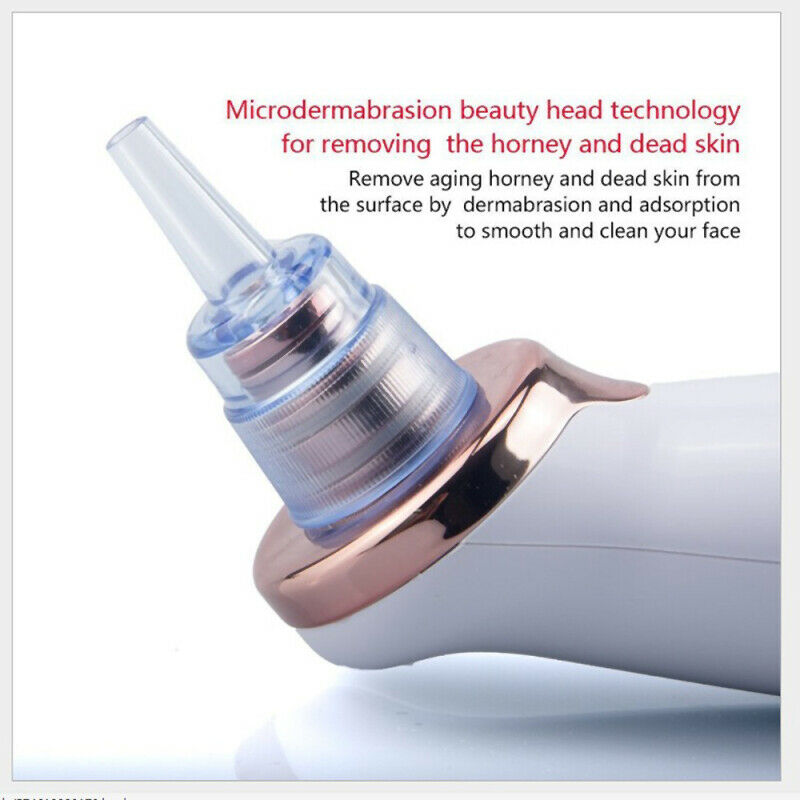 Electric Blackhead Remover Pore Vacuum Suction Diamond Dermabrasion Face C FDZ