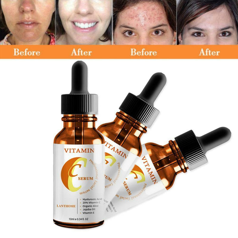 Advanced Vitamin C Serum Hyaluronic Acid, Aloe Vera, Argan Oil & Vitamin E V5R4