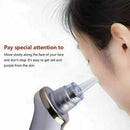 Electric Face Blackhead Remover Diamond Pore Vacuum Cleaner Dermabrasion w/Head