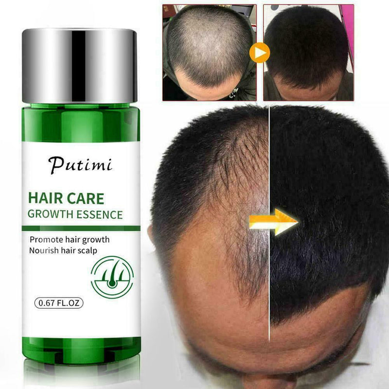 Hair Growth Dense Regrowth Ginger Serum Oil Anti Loss Treatment Essence 20M T1W7