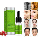 10ml Face Essence Care Hyaluronic Whitening Shrink Pores X6E5 M8E6 U6Q0