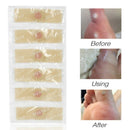 42Pcs Medical Plasters Foot Corn Removal Warts Thorn Patch Curative Patches